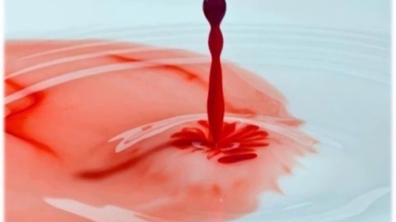 penisten kanlı akıntı