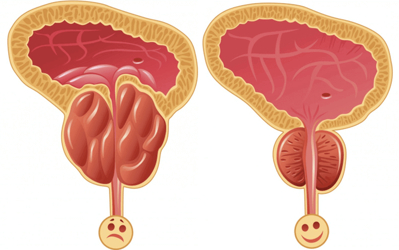 erkeklerde iktidar sorunlarının nedenleri